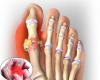 Bệnh Viêm Khớp Cách Điều Trị Không Khó Như Bạn Nghĩ
